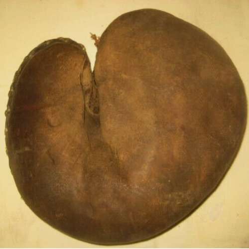 Edward K. Tryon Catchers Mitt Front
