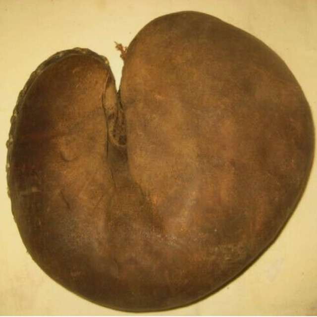 Edward K. Tryon Catchers Mitt Front